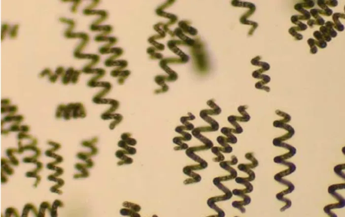 Frequently Asked Questions About Spirulina Farming