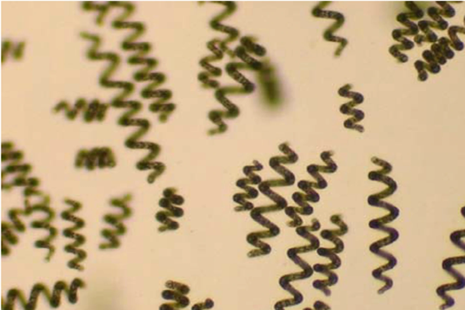 Frequently Asked Questions About Spirulina Farming